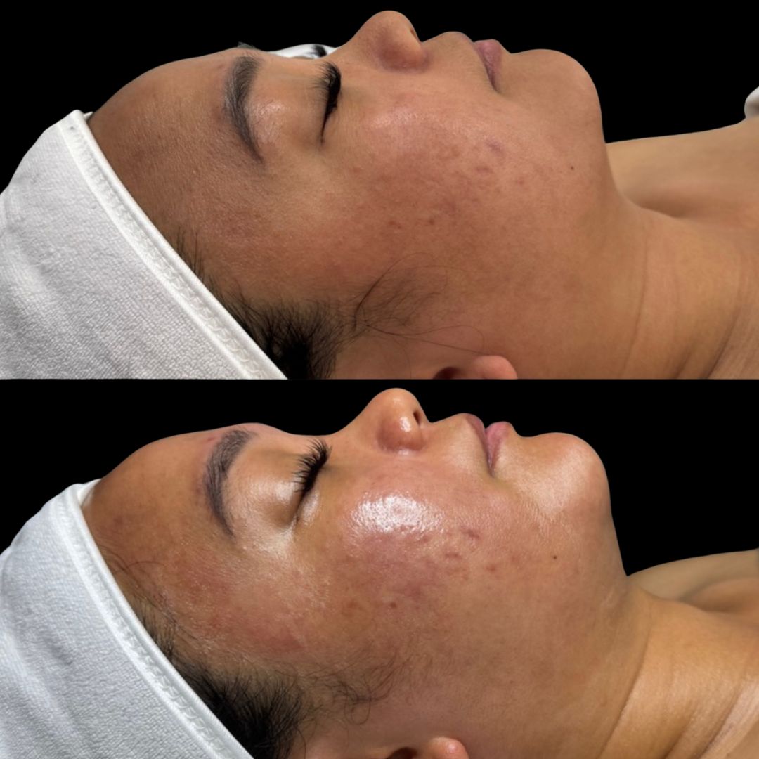 Customized Signature Care