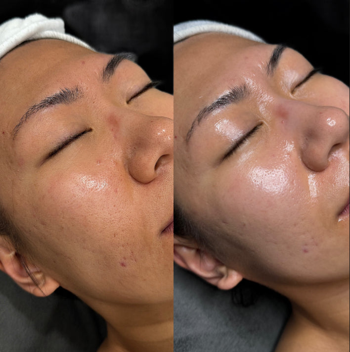 K-glow boosting care