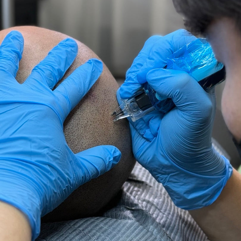 SMP(Scalp Micropigmentation)