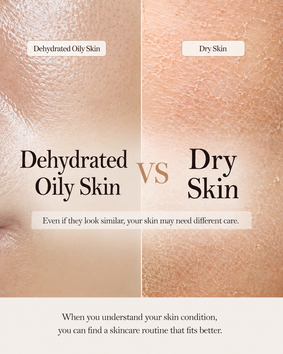 Dehydrated vs. Dry Skin: What’s the Difference?