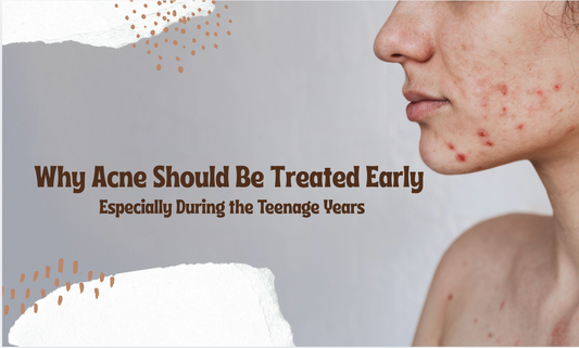 Why Acne Should Be Treated Early — Especially During the Teenage Years